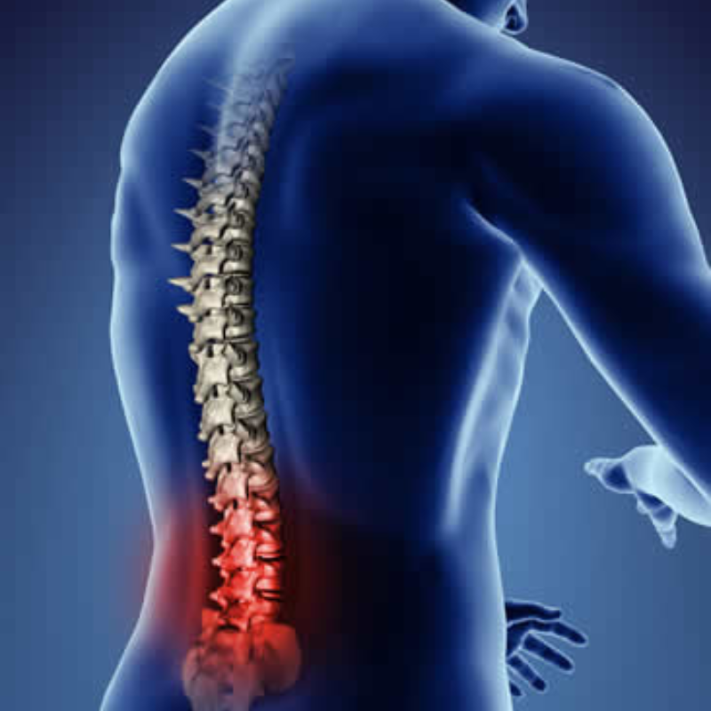 Lumbar Spondylosis